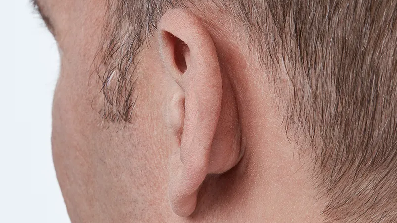 Oticon Opn&trade; G&ouml;r&uuml;nmez Kanal İ&ccedil;i (IIC)